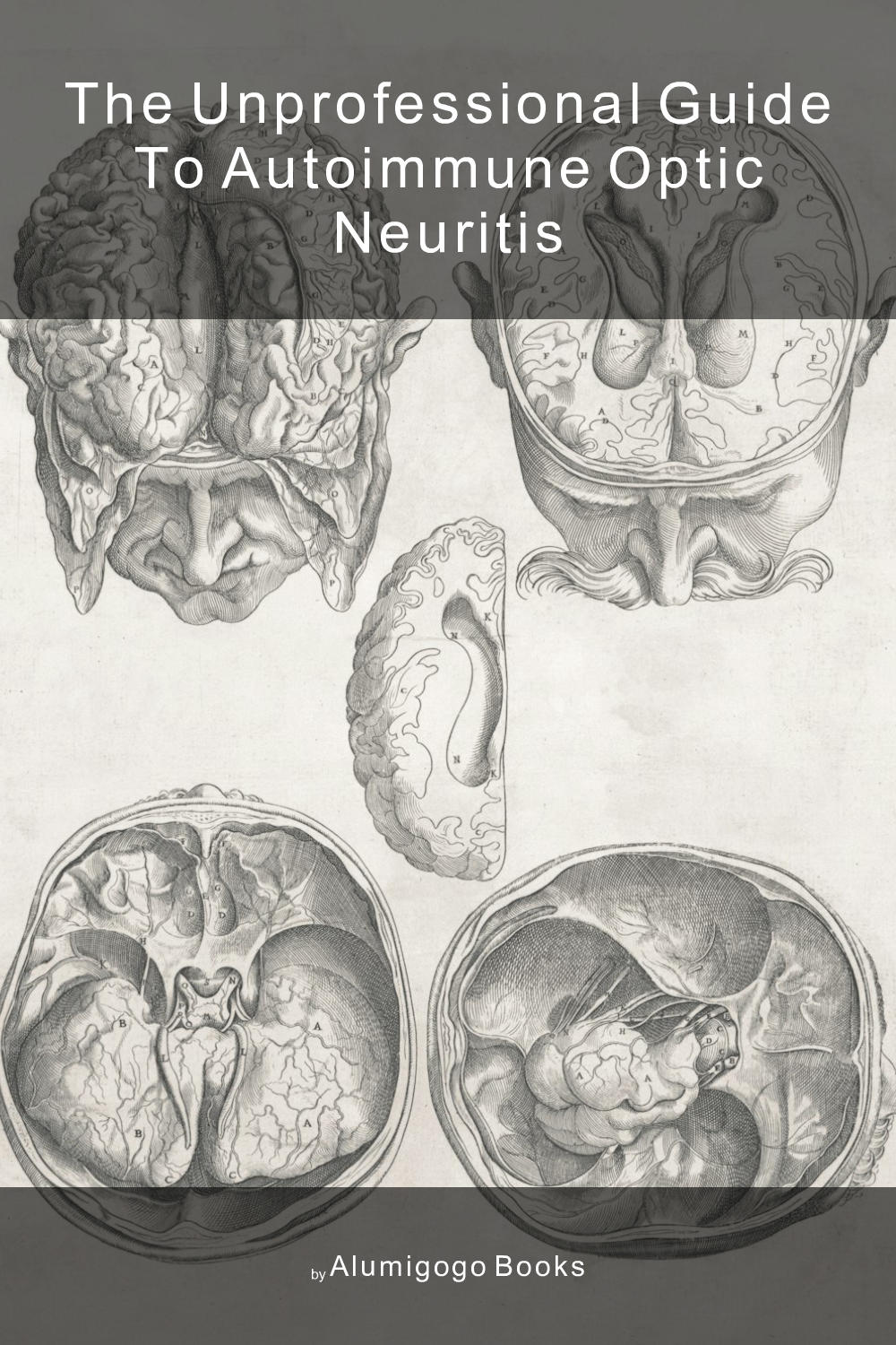 Cover of The Unprofessional Guide to autoimmune optic neuritis
