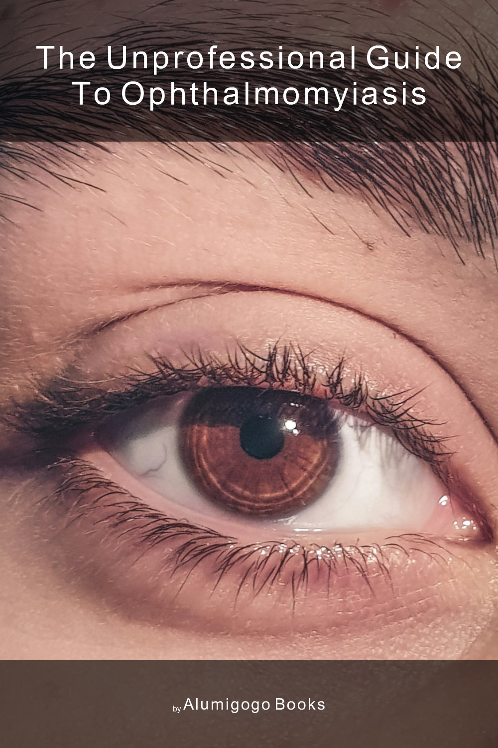 Cover of The Unprofessional Guide to ophthalmomyiasis