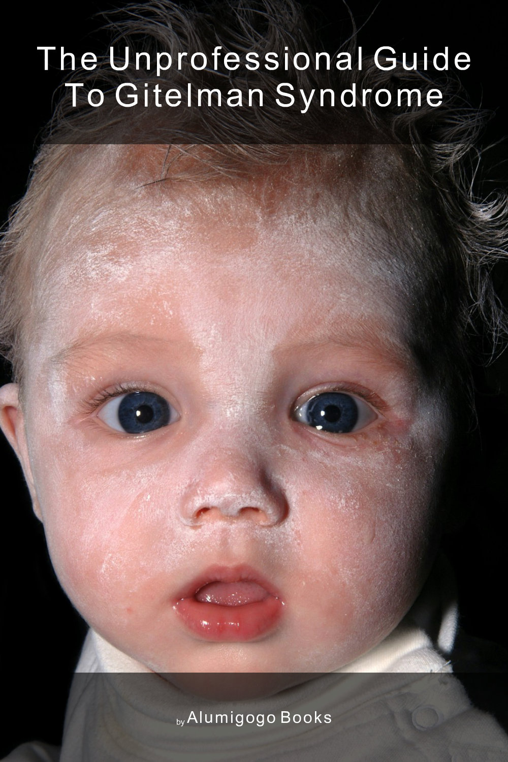 Cover of The Unprofessional Guide to Gitelman syndrome