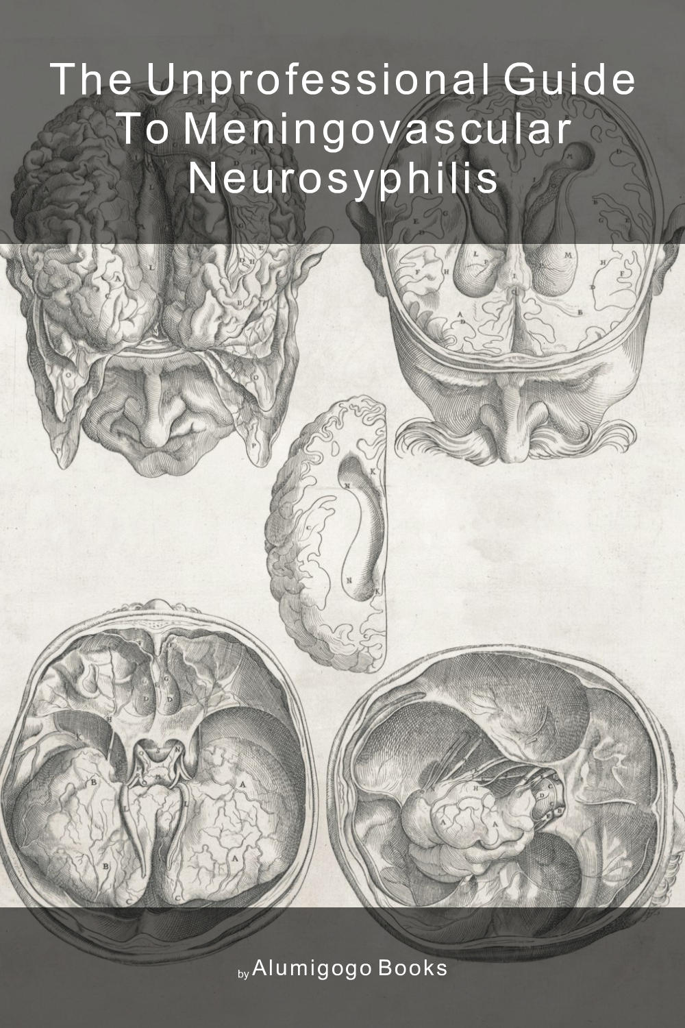 Cover of The Unprofessional Guide to meningovascular neurosyphilis