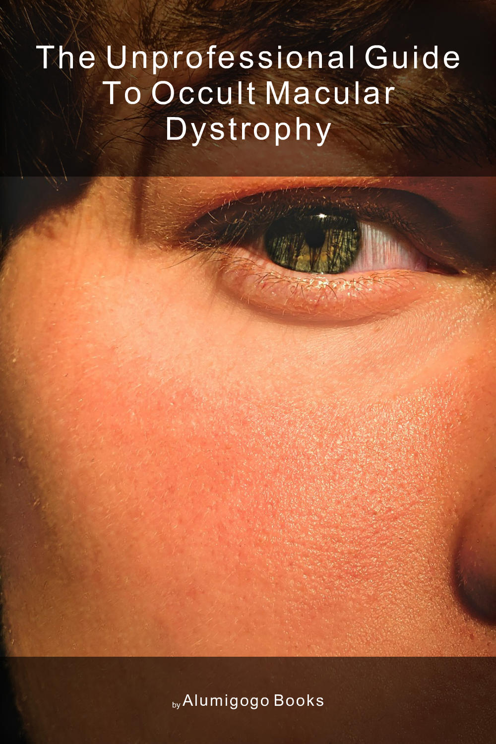 Cover of The Unprofessional Guide to occult macular dystrophy