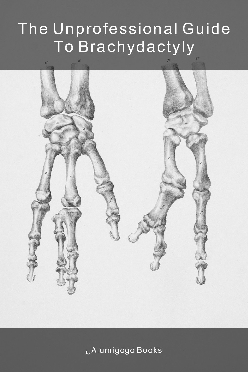 Cover of The Unprofessional Guide to brachydactyly