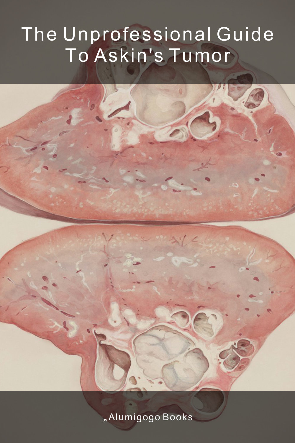 Cover of The Unprofessional Guide to Askin's tumor