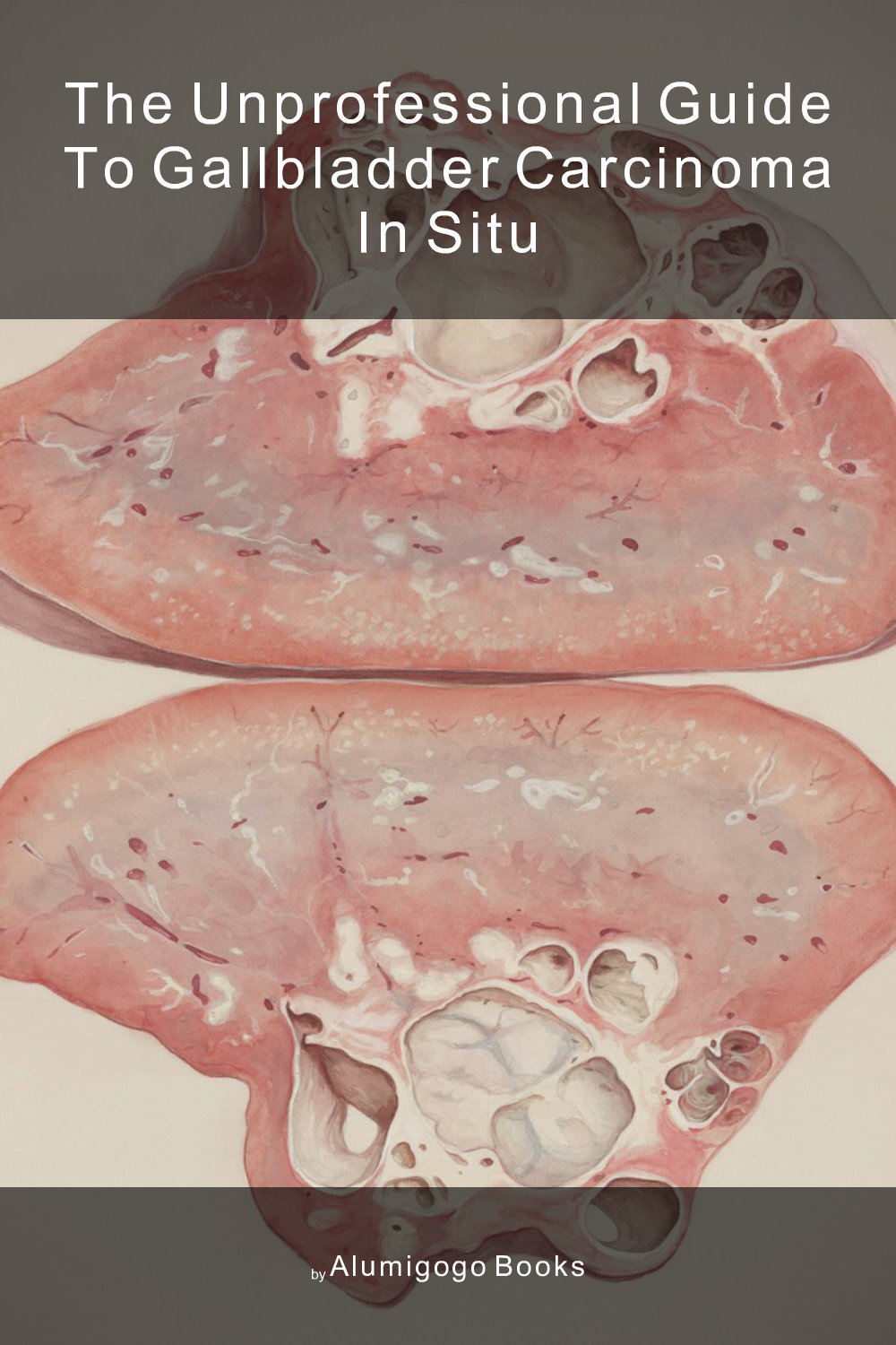 Cover of The Unprofessional Guide to gallbladder carcinoma in situ