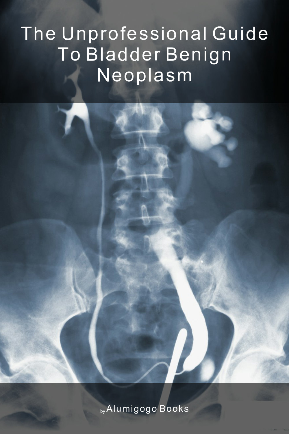 Cover of The Unprofessional Guide to bladder benign neoplasm