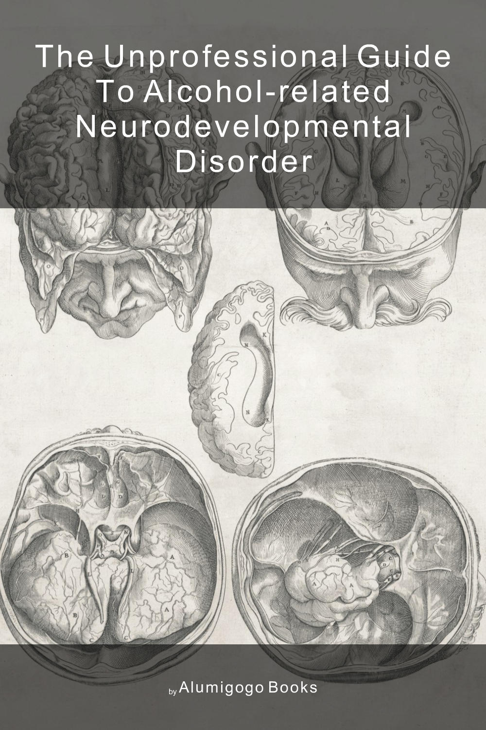 Cover of The Unprofessional Guide to alcohol-related neurodevelopmental disorder