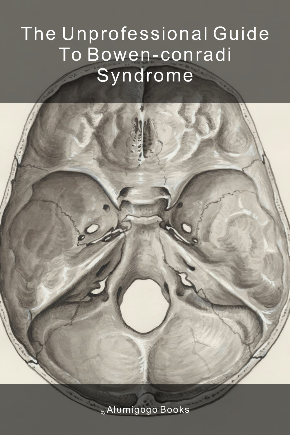 Cover of The Unprofessional Guide to Bowen-Conradi syndrome