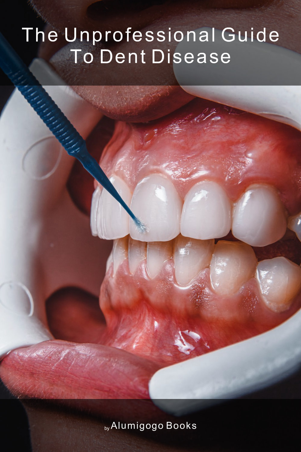Cover of The Unprofessional Guide to Dent disease
