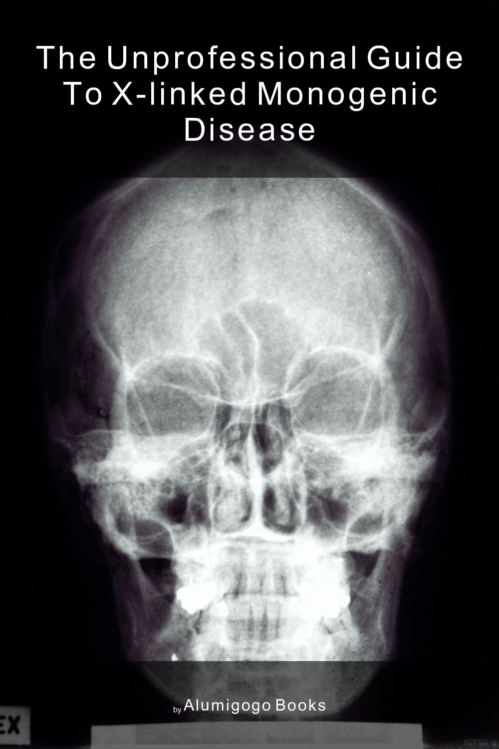 Cover of The Unprofessional Guide to X-linked monogenic disease