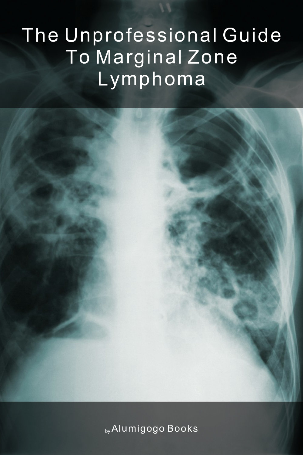 Cover of The Unprofessional Guide to marginal zone lymphoma
