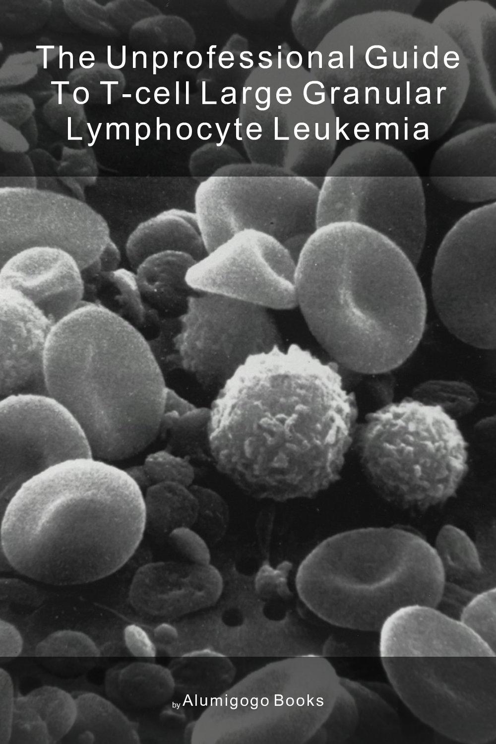 Cover of The Unprofessional Guide to T-cell large granular lymphocyte leukemia