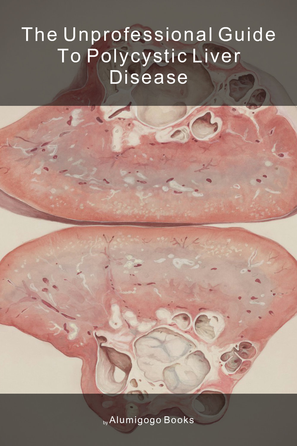 Cover of The Unprofessional Guide to polycystic liver disease