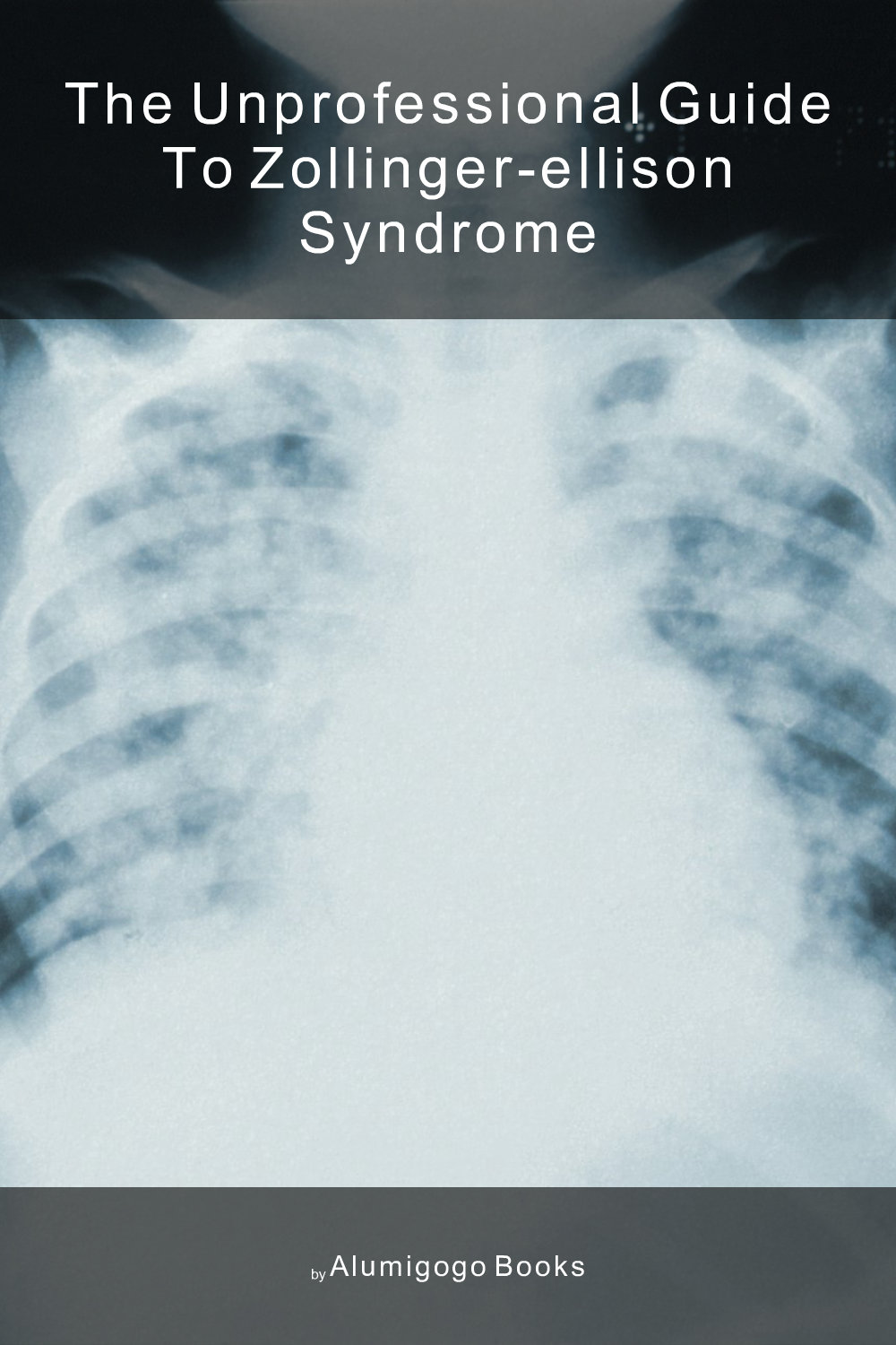 Cover of The Unprofessional Guide to Zollinger-Ellison syndrome