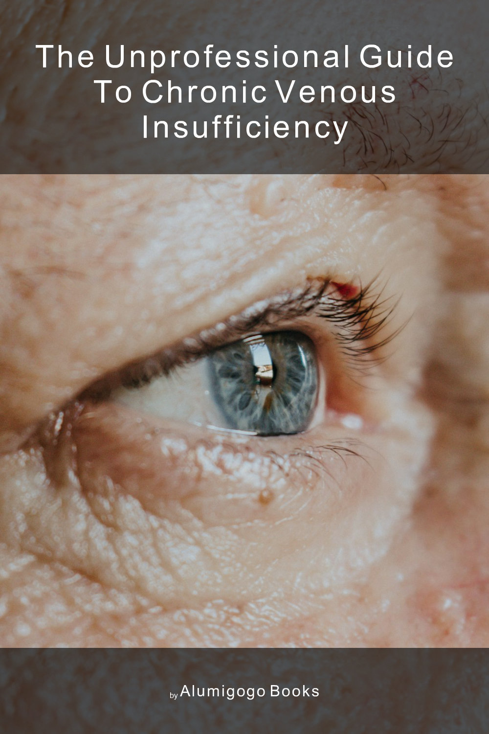 Cover of The Unprofessional Guide to chronic venous insufficiency