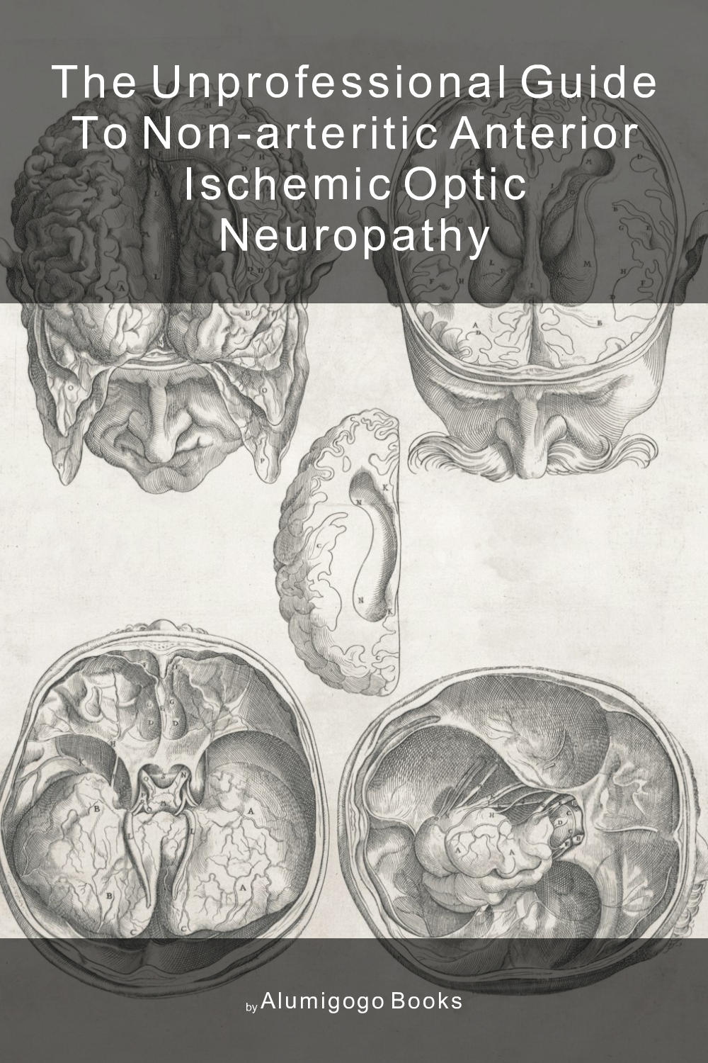 Cover of The Unprofessional Guide to non-arteritic anterior ischemic optic neuropathy