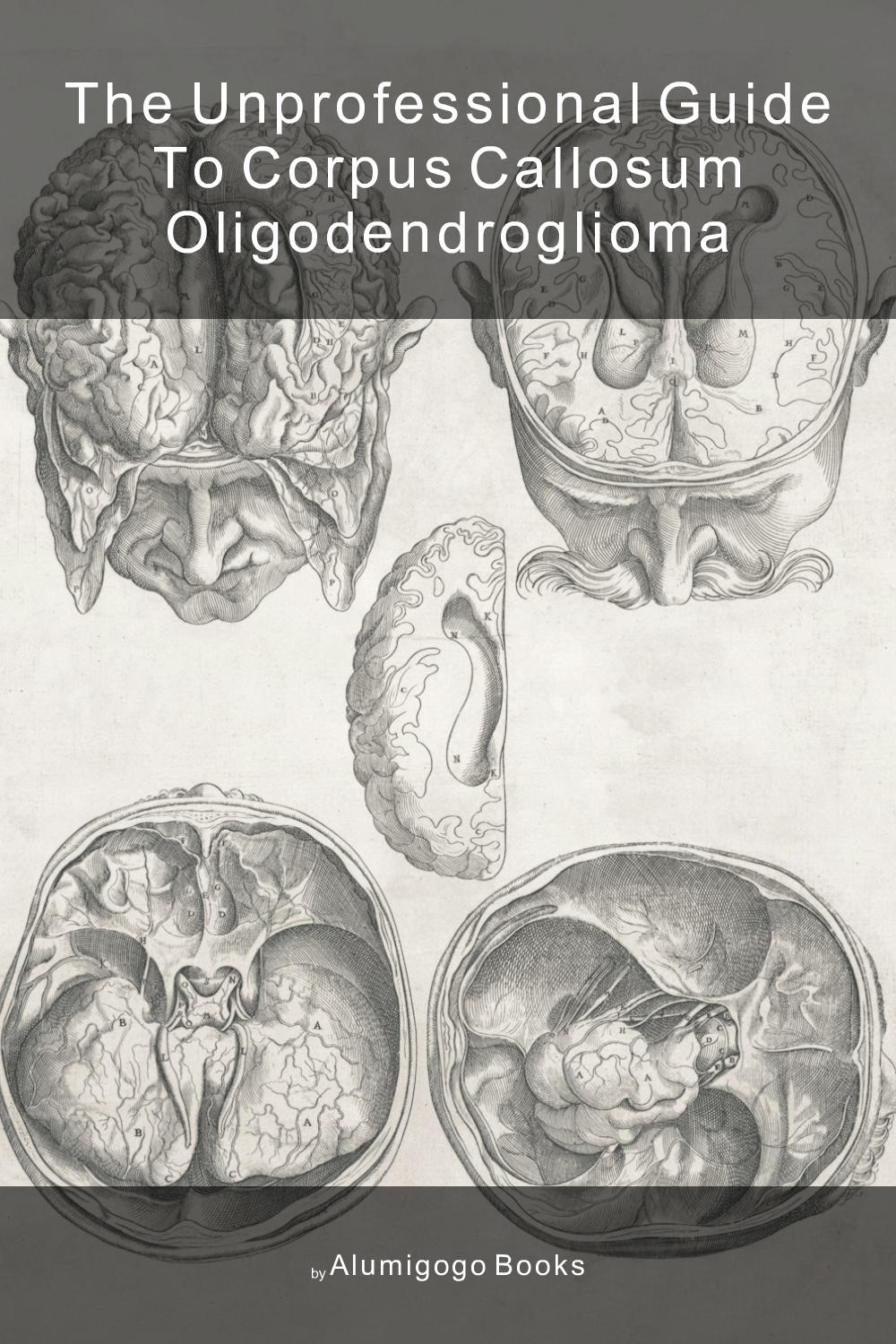 Cover of The Unprofessional Guide to corpus callosum oligodendroglioma