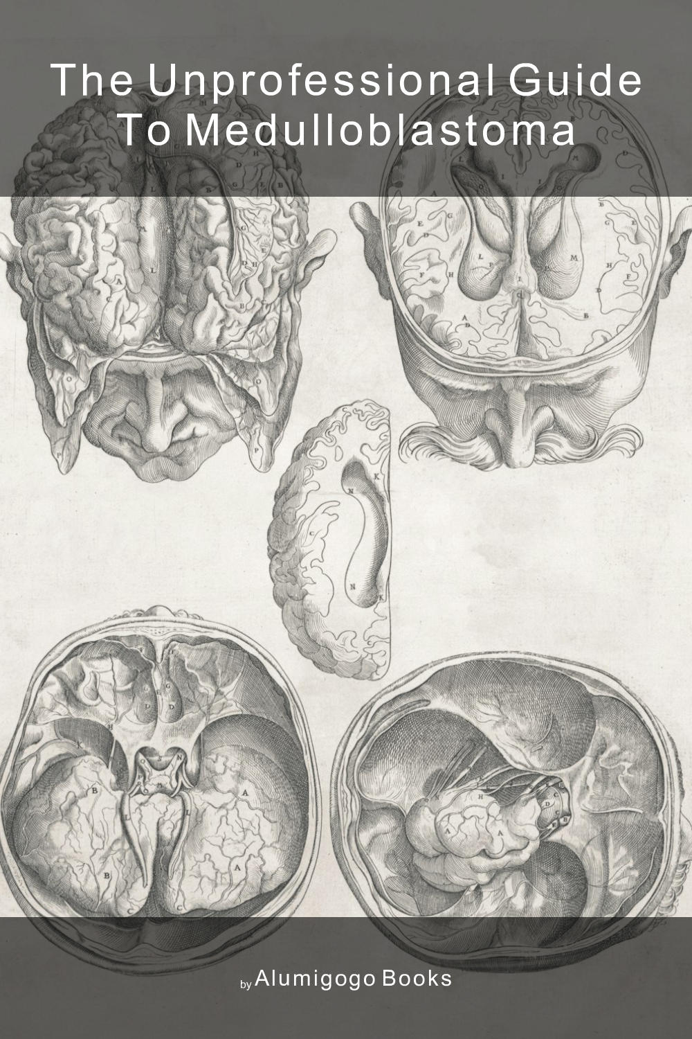 Cover of The Unprofessional Guide to medulloblastoma