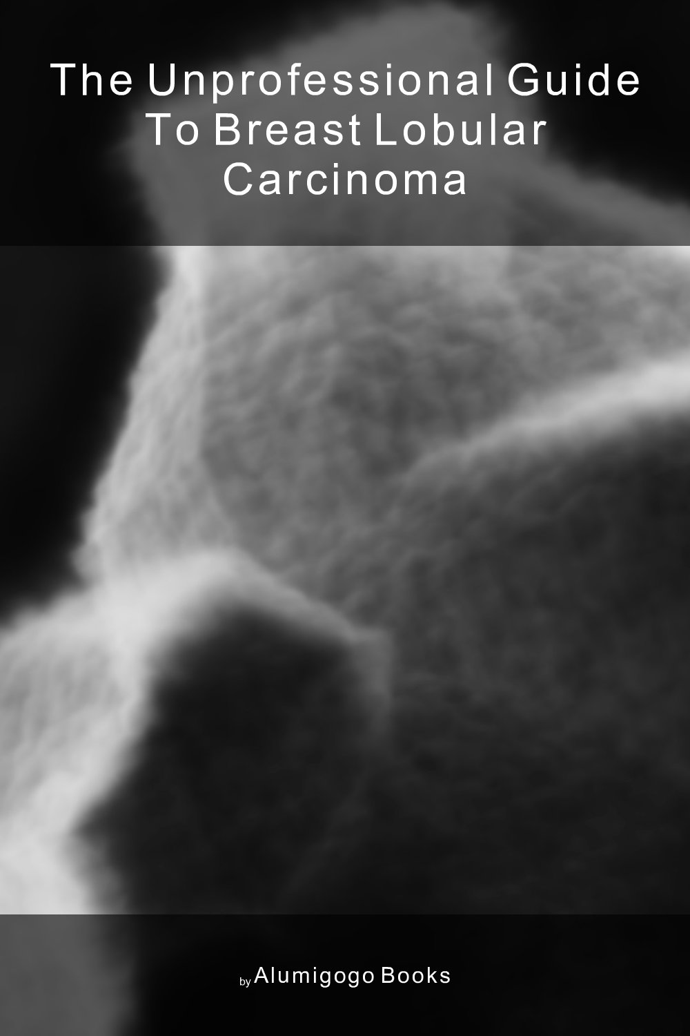 Cover of The Unprofessional Guide to breast lobular carcinoma
