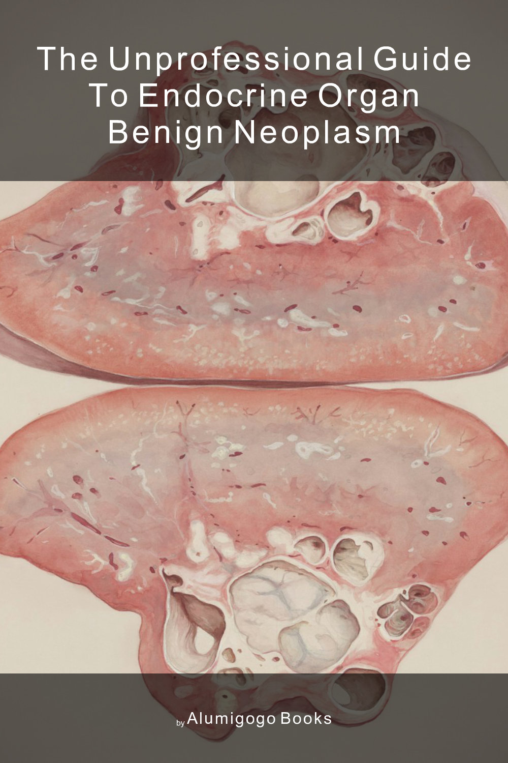 Cover of The Unprofessional Guide to endocrine organ benign neoplasm