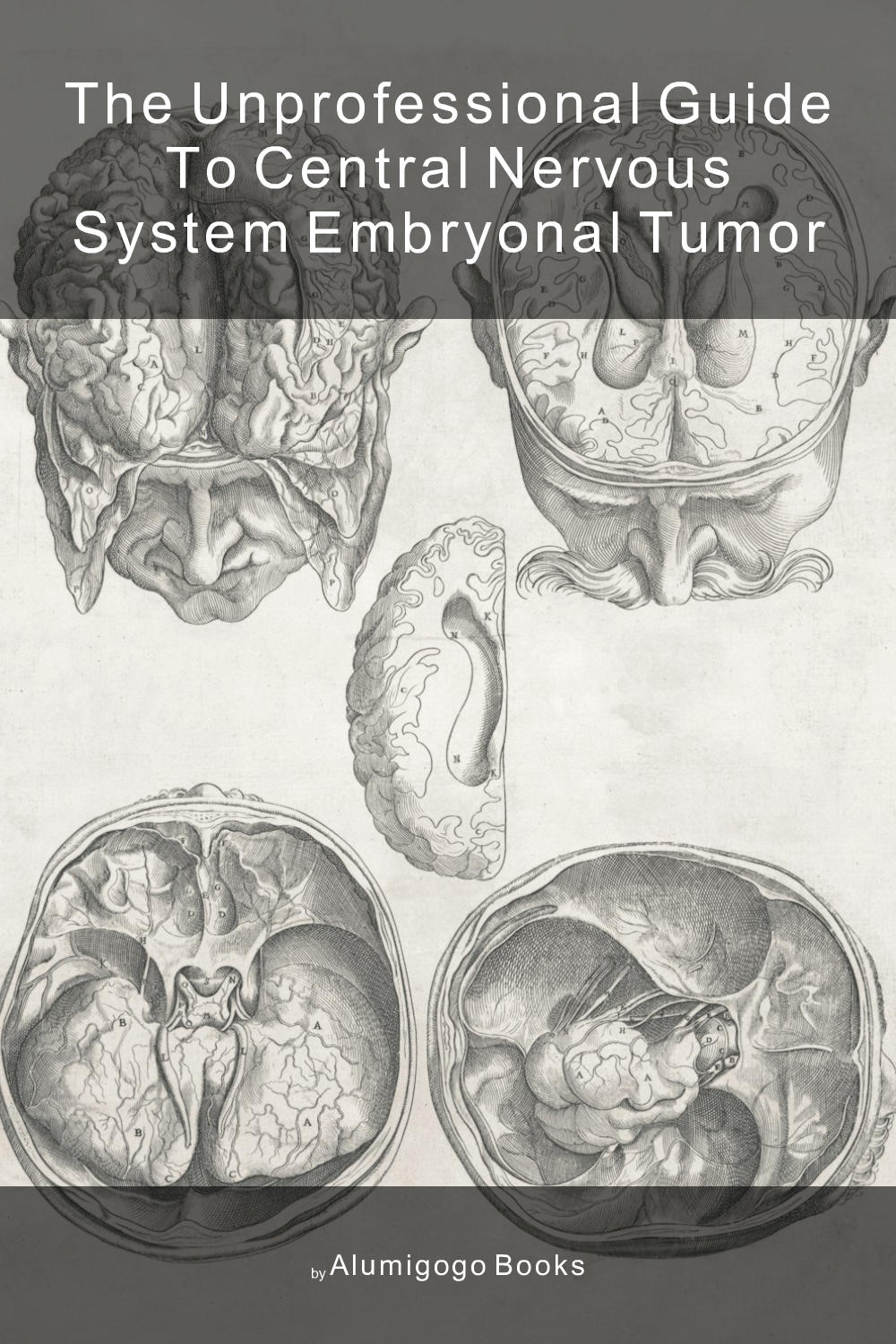 Cover of The Unprofessional Guide to central nervous system embryonal tumor