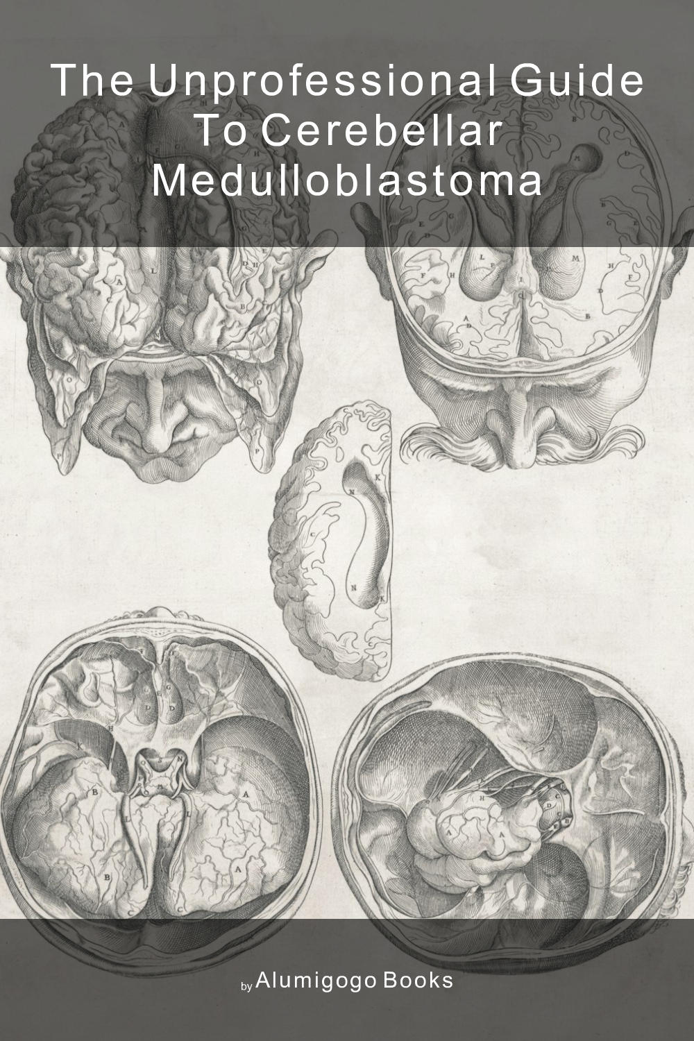 Cover of The Unprofessional Guide to cerebellar medulloblastoma