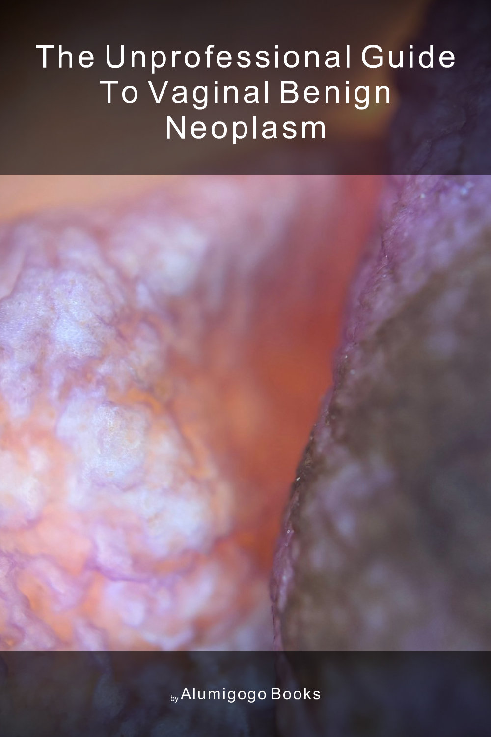 Cover of The Unprofessional Guide to vaginal benign neoplasm