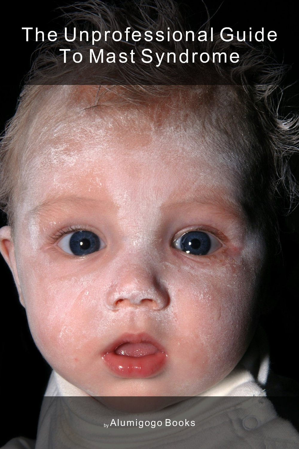 Cover of The Unprofessional Guide to Mast syndrome