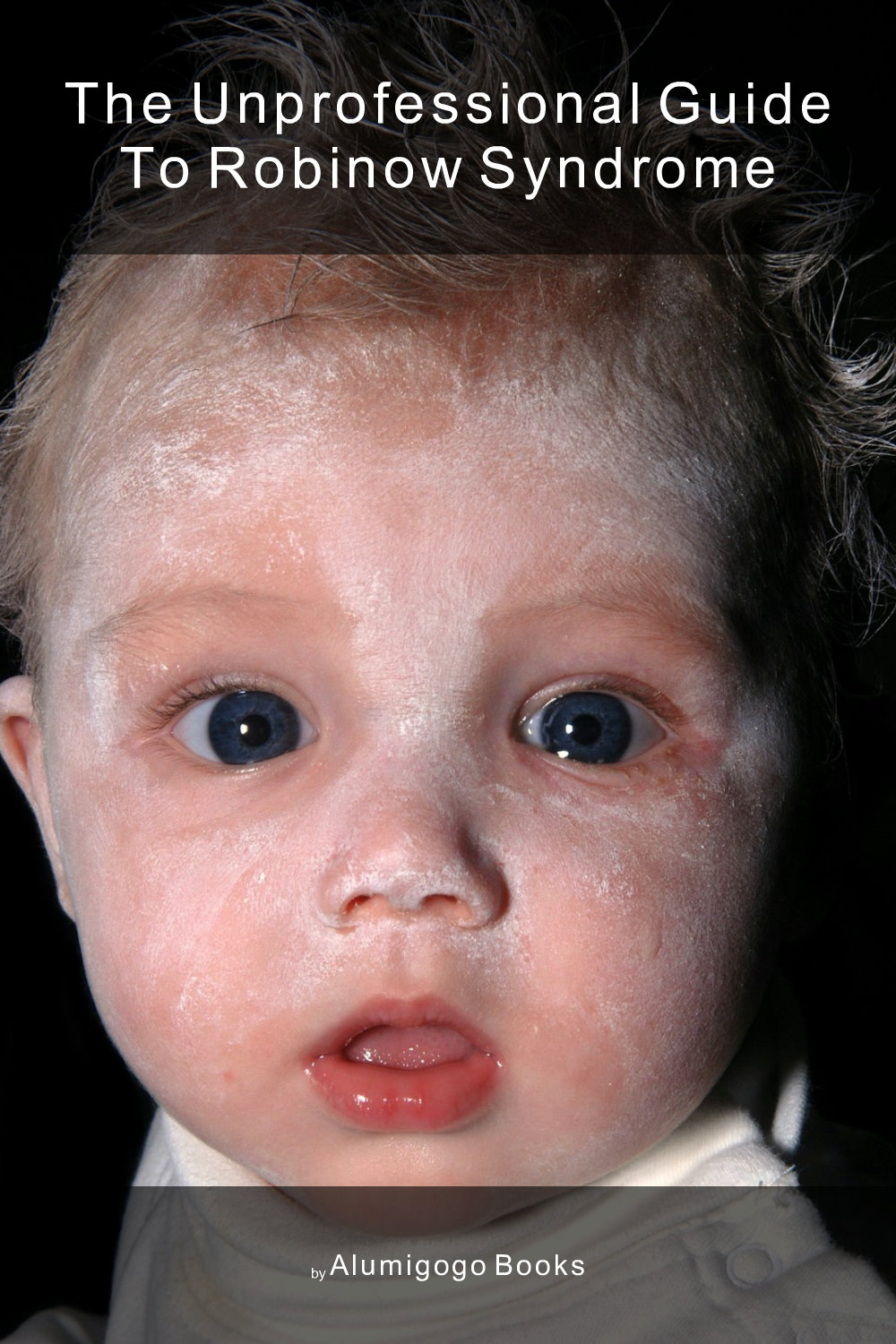 Cover of The Unprofessional Guide to Robinow syndrome
