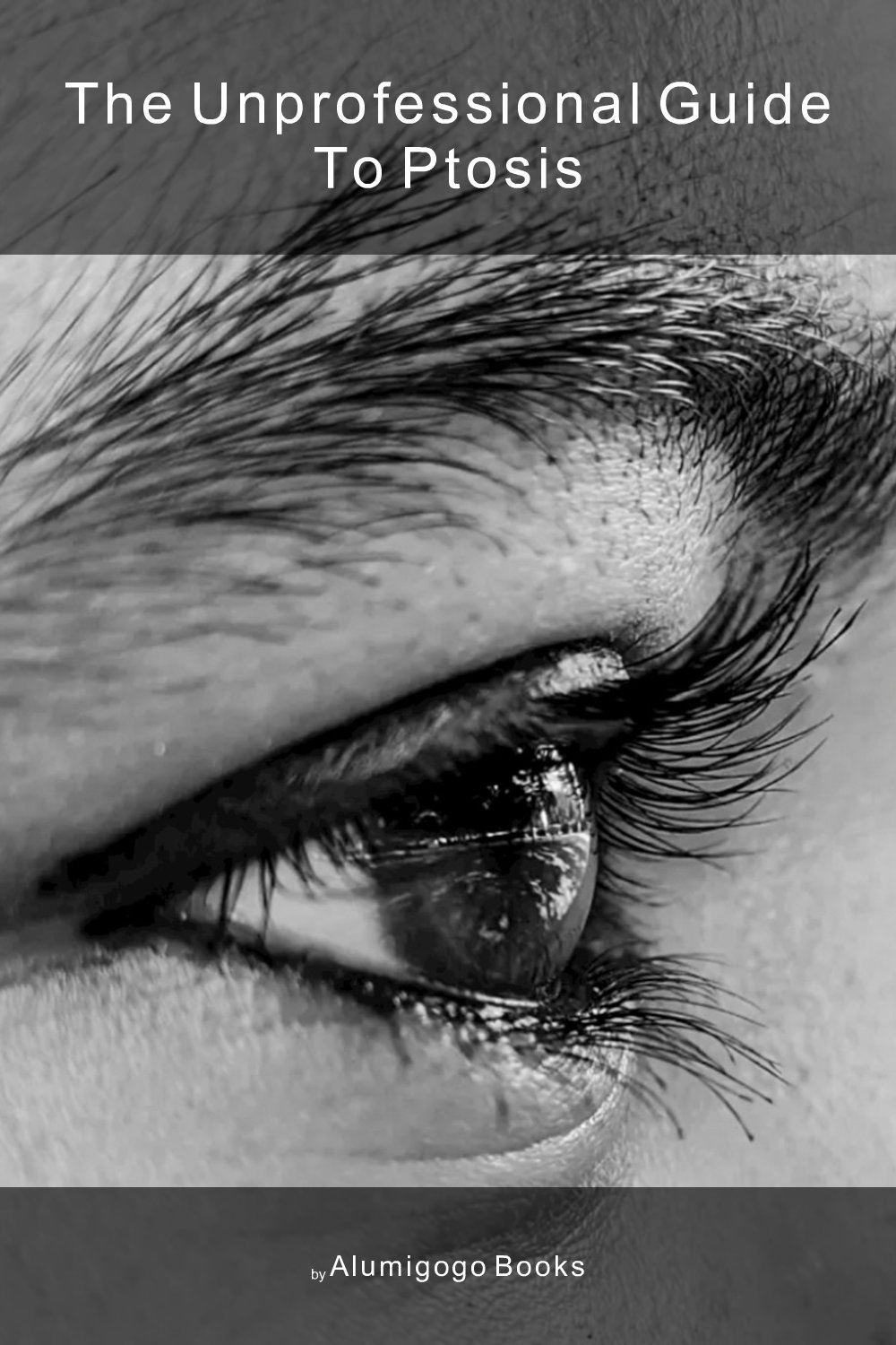 Cover of The Unprofessional Guide to ptosis