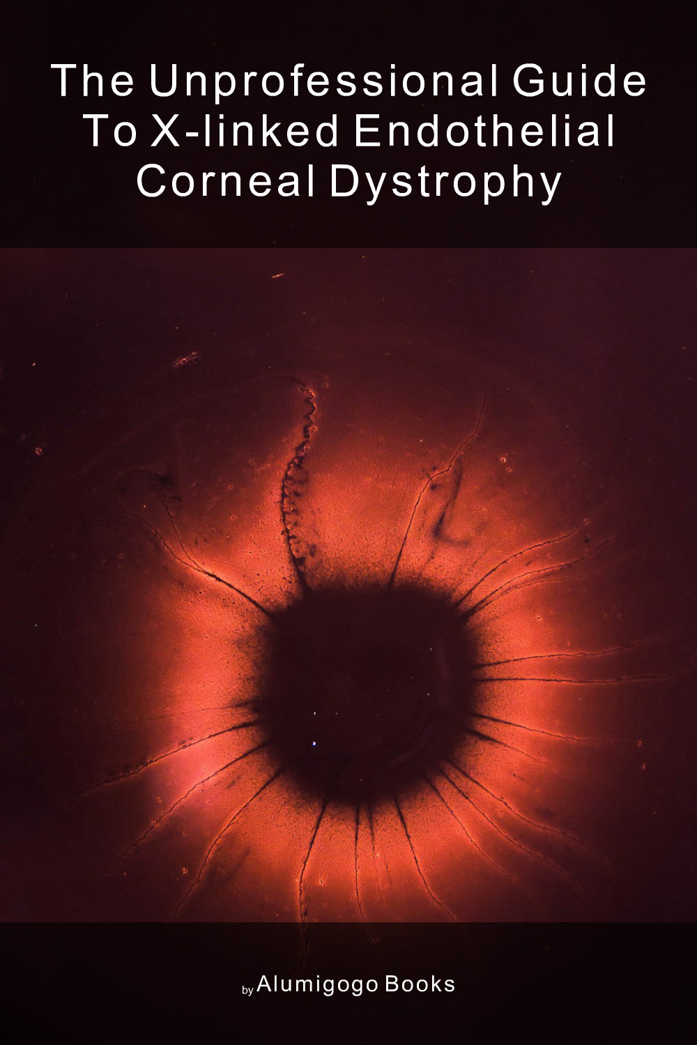 Cover of The Unprofessional Guide to X-linked endothelial corneal dystrophy