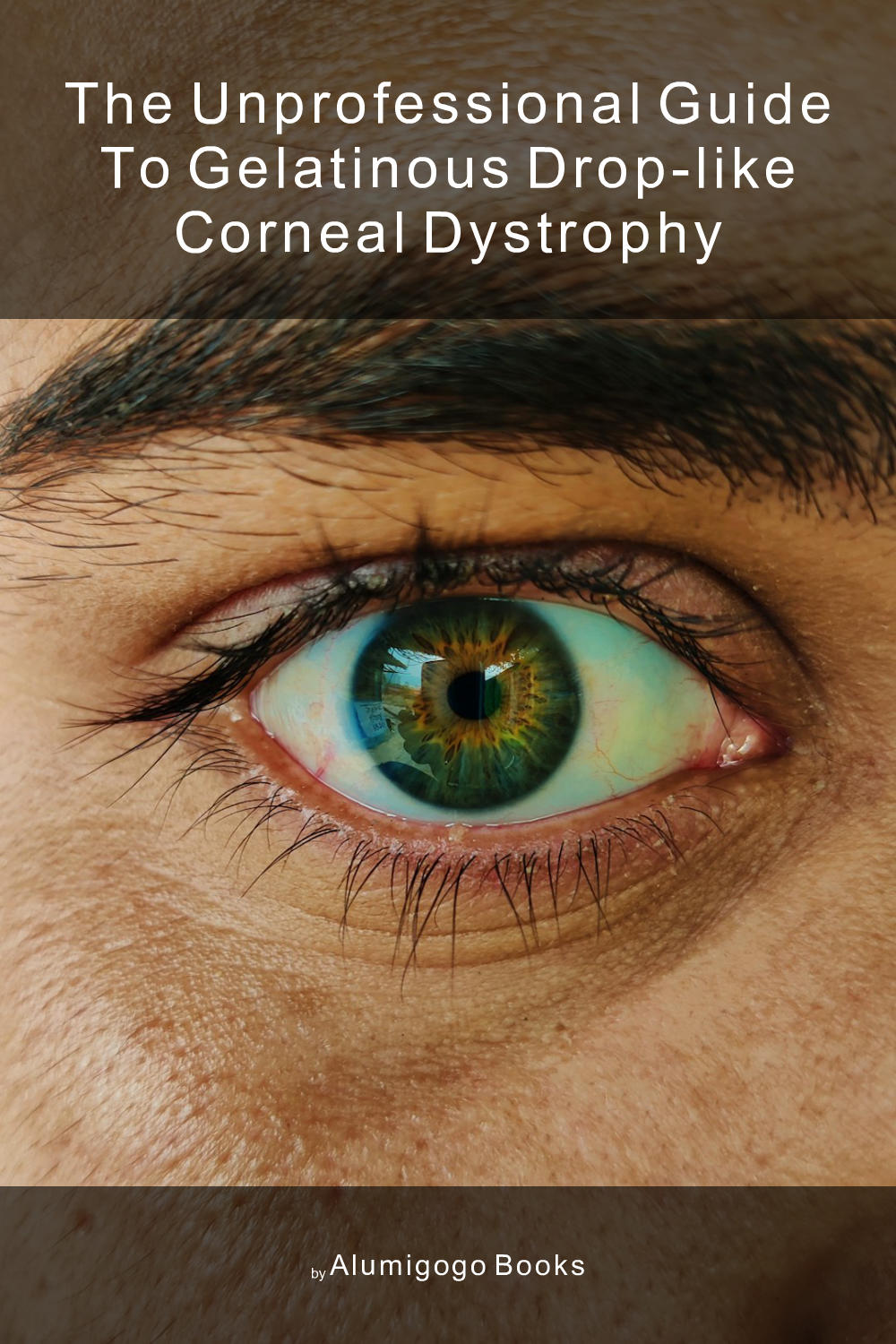Cover of The Unprofessional Guide to gelatinous drop-like corneal dystrophy