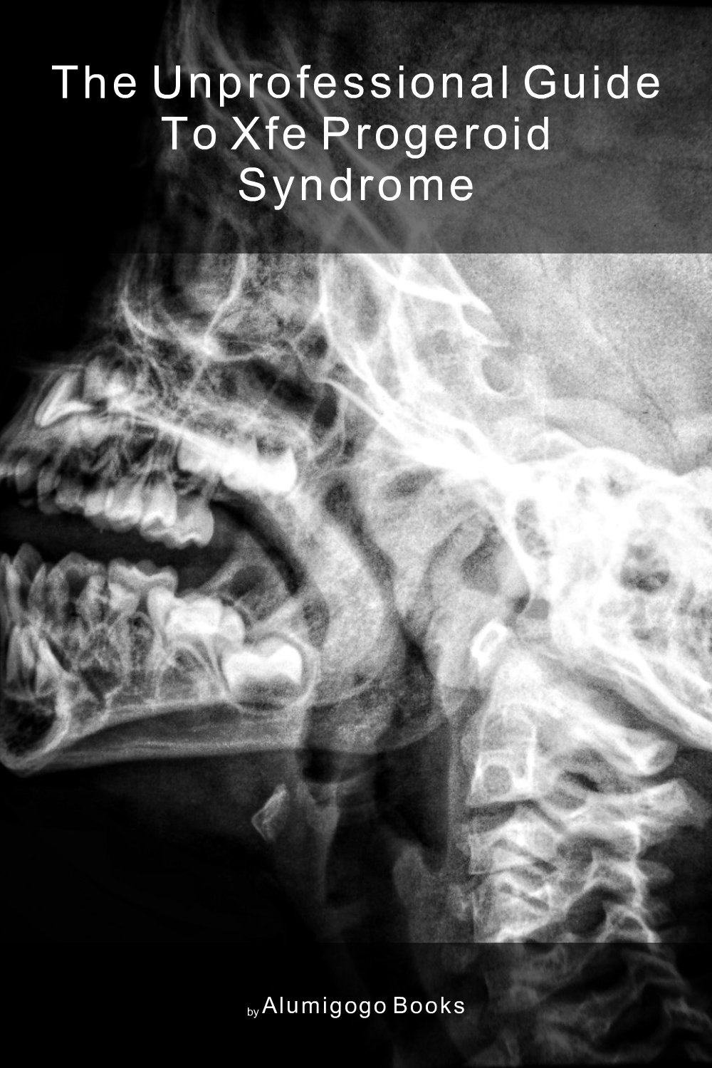 Cover of The Unprofessional Guide to XFE progeroid syndrome