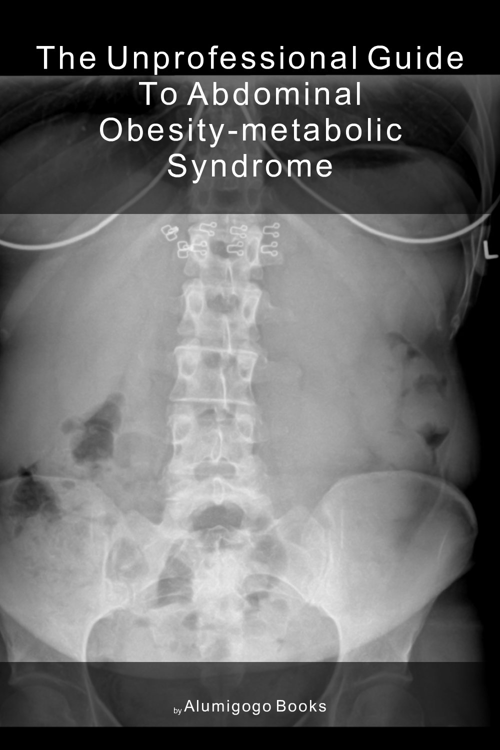 Cover of The Unprofessional Guide to abdominal obesity-metabolic syndrome