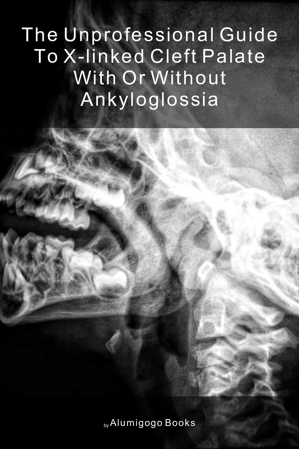 Cover of The Unprofessional Guide to X-linked cleft palate with or without ankyloglossia