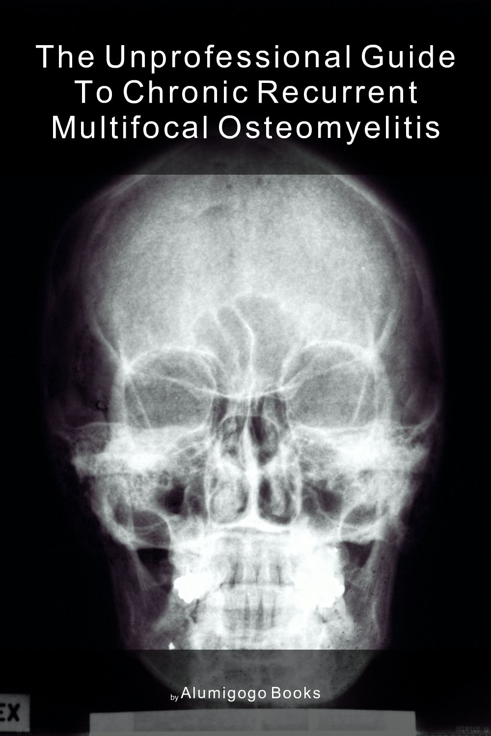 Cover of The Unprofessional Guide to chronic recurrent multifocal osteomyelitis