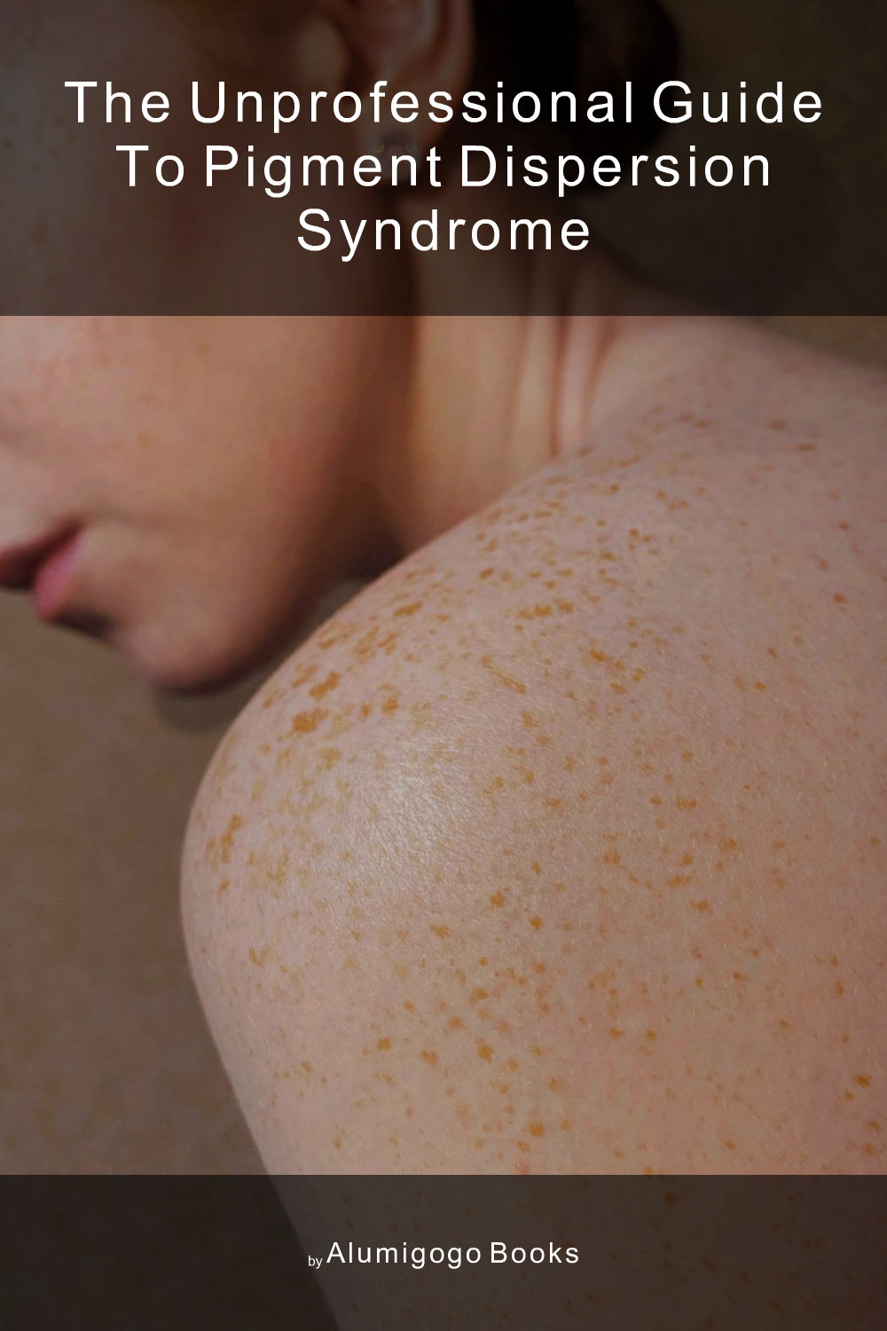 Cover of The Unprofessional Guide to pigment dispersion syndrome
