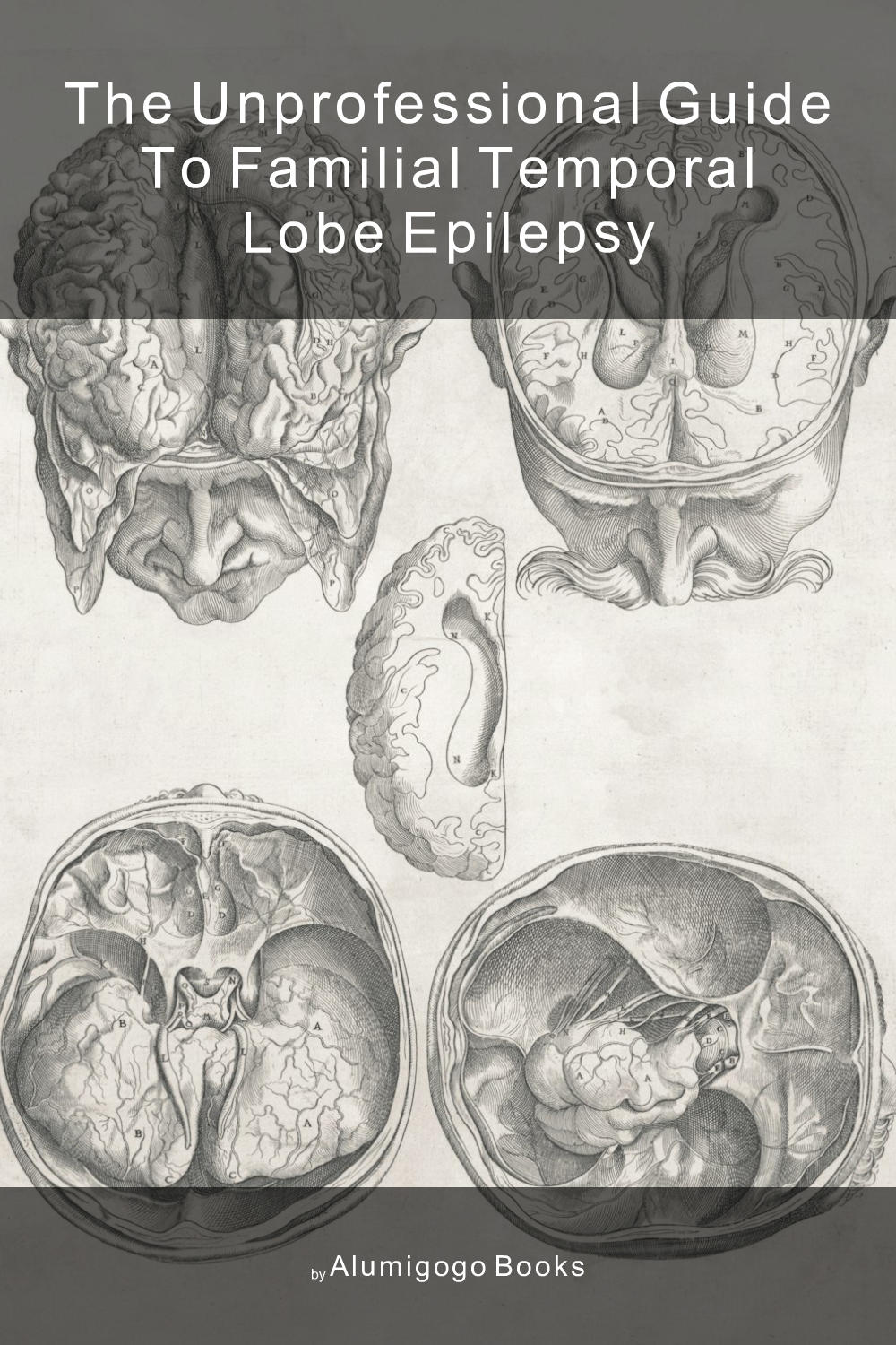 Cover of The Unprofessional Guide to familial temporal lobe epilepsy