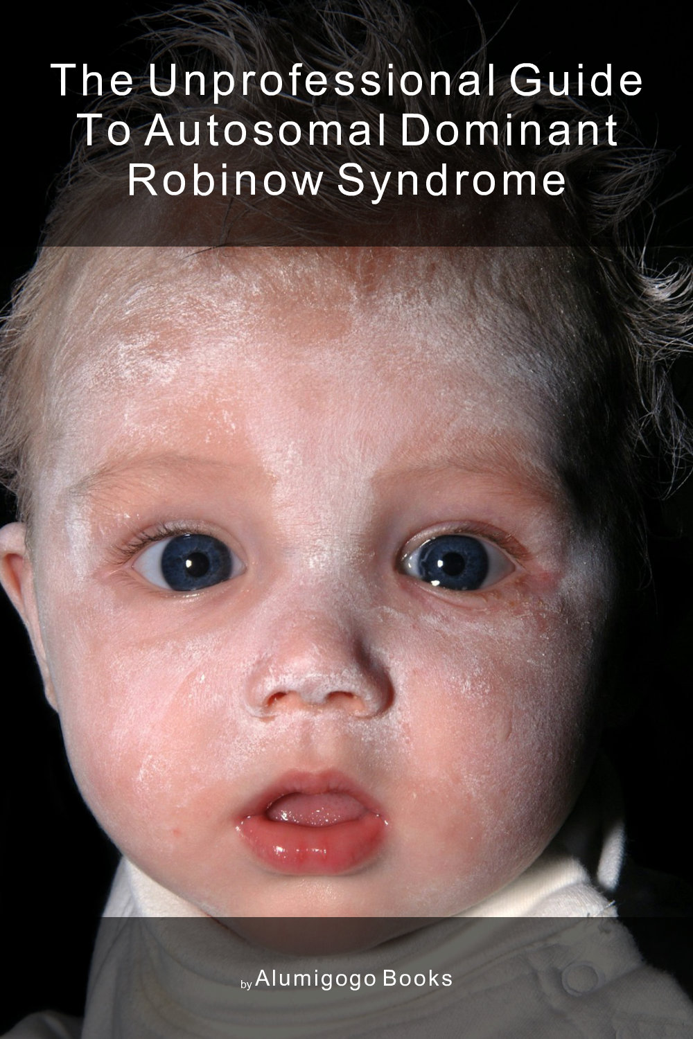Cover of The Unprofessional Guide to autosomal dominant Robinow syndrome