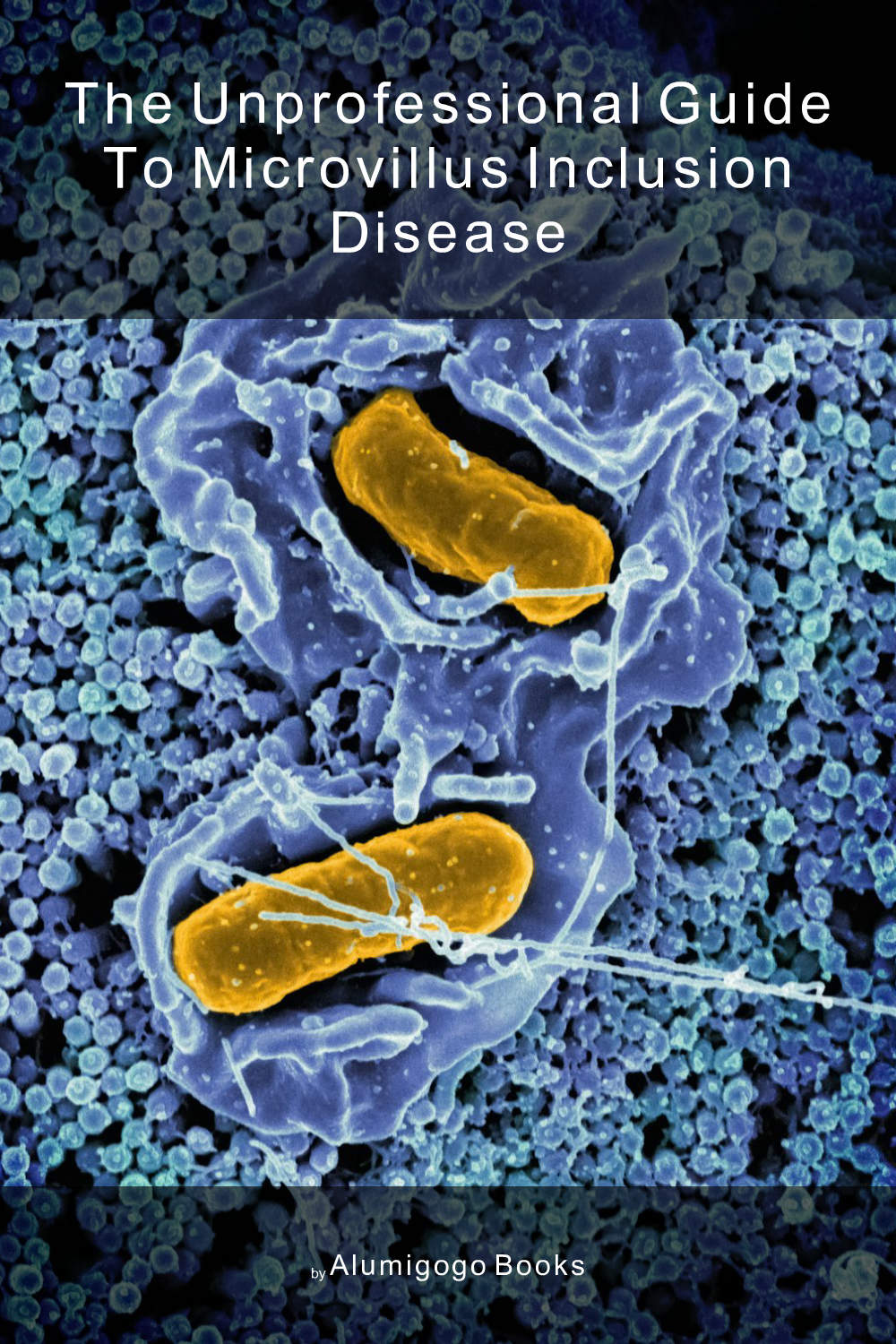 Cover of The Unprofessional Guide to microvillus inclusion disease