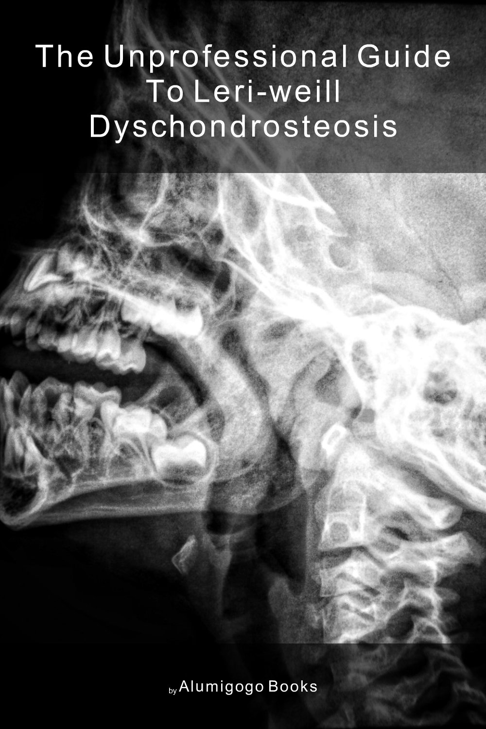 Cover of The Unprofessional Guide to Leri-Weill dyschondrosteosis