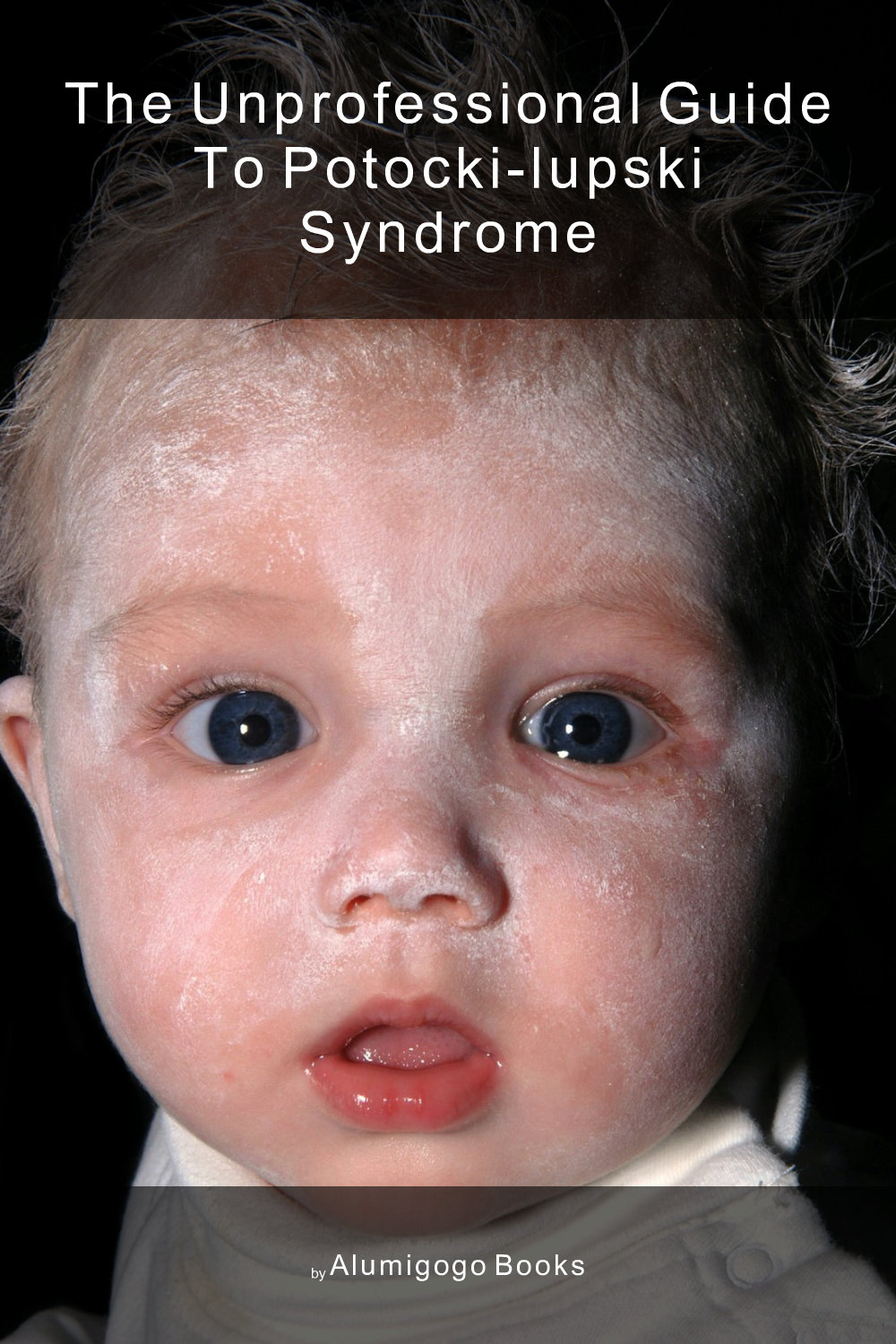 Cover of The Unprofessional Guide to Potocki-Lupski syndrome