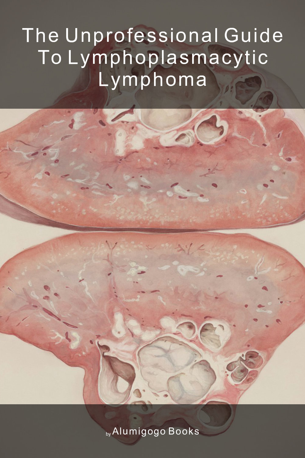 Cover of The Unprofessional Guide to lymphoplasmacytic lymphoma