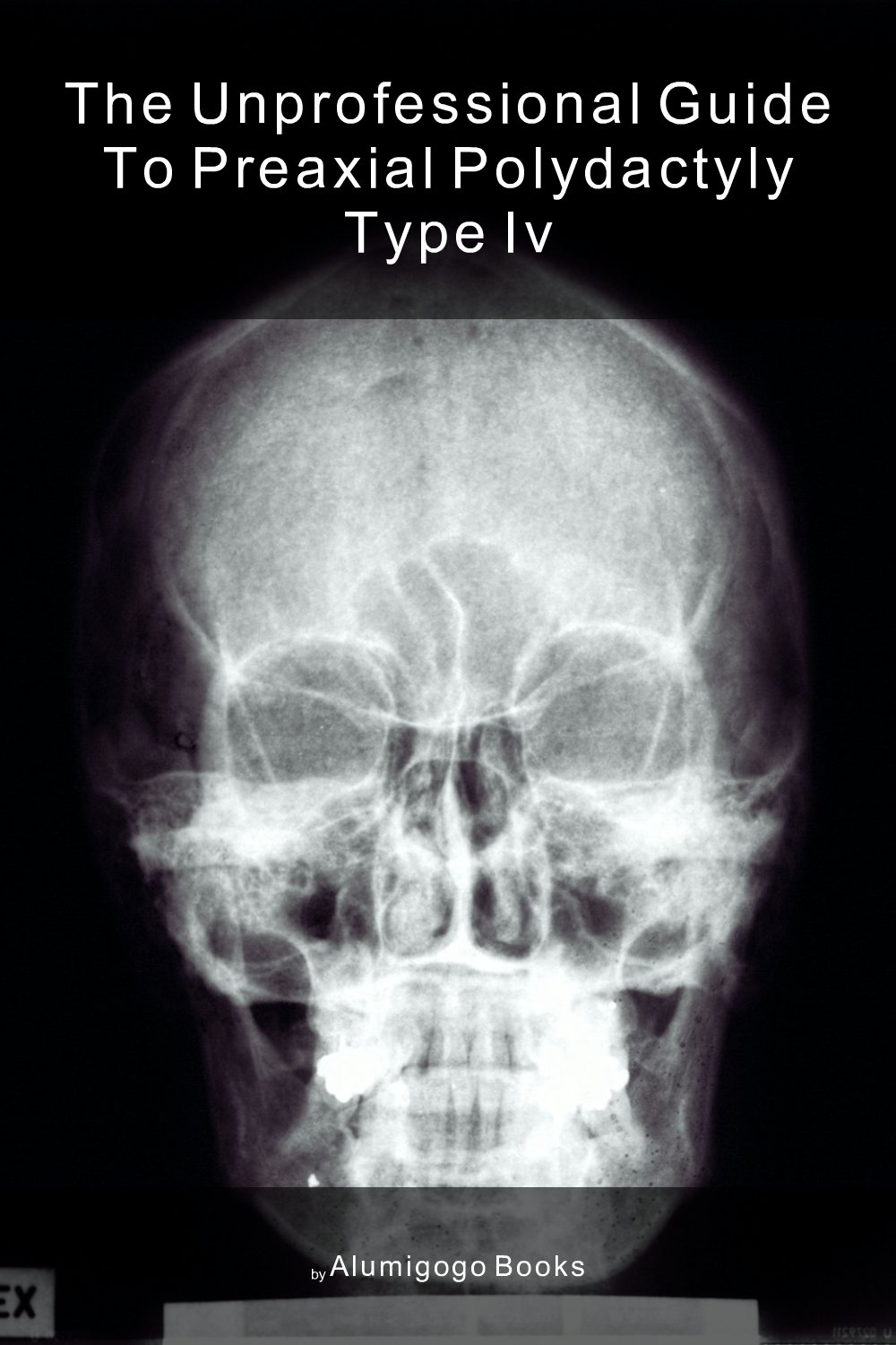 Cover of The Unprofessional Guide to preaxial polydactyly type IV