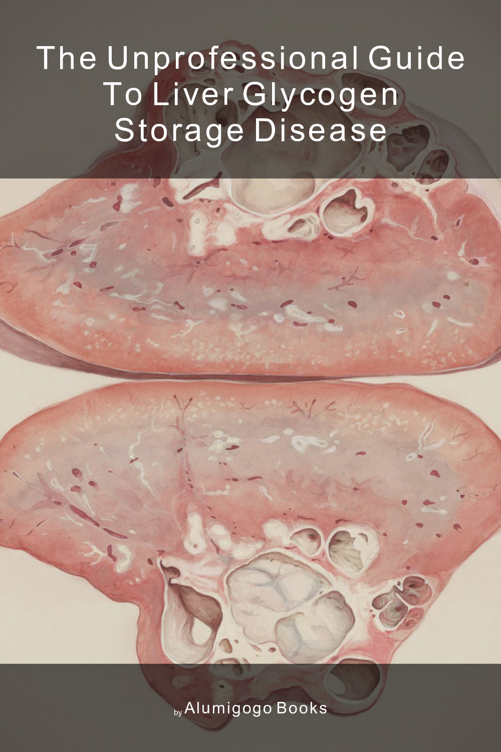 Cover of The Unprofessional Guide to liver glycogen storage disease