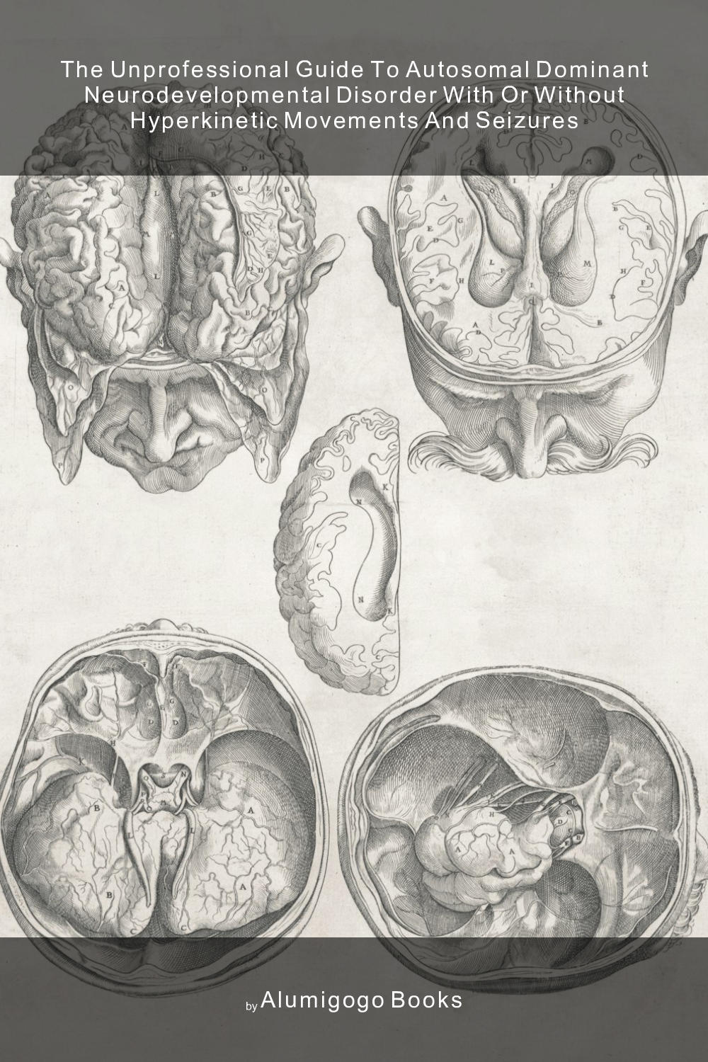 Cover of The Unprofessional Guide to autosomal dominant neurodevelopmental disorder with or without hyperkinetic movements and seizures