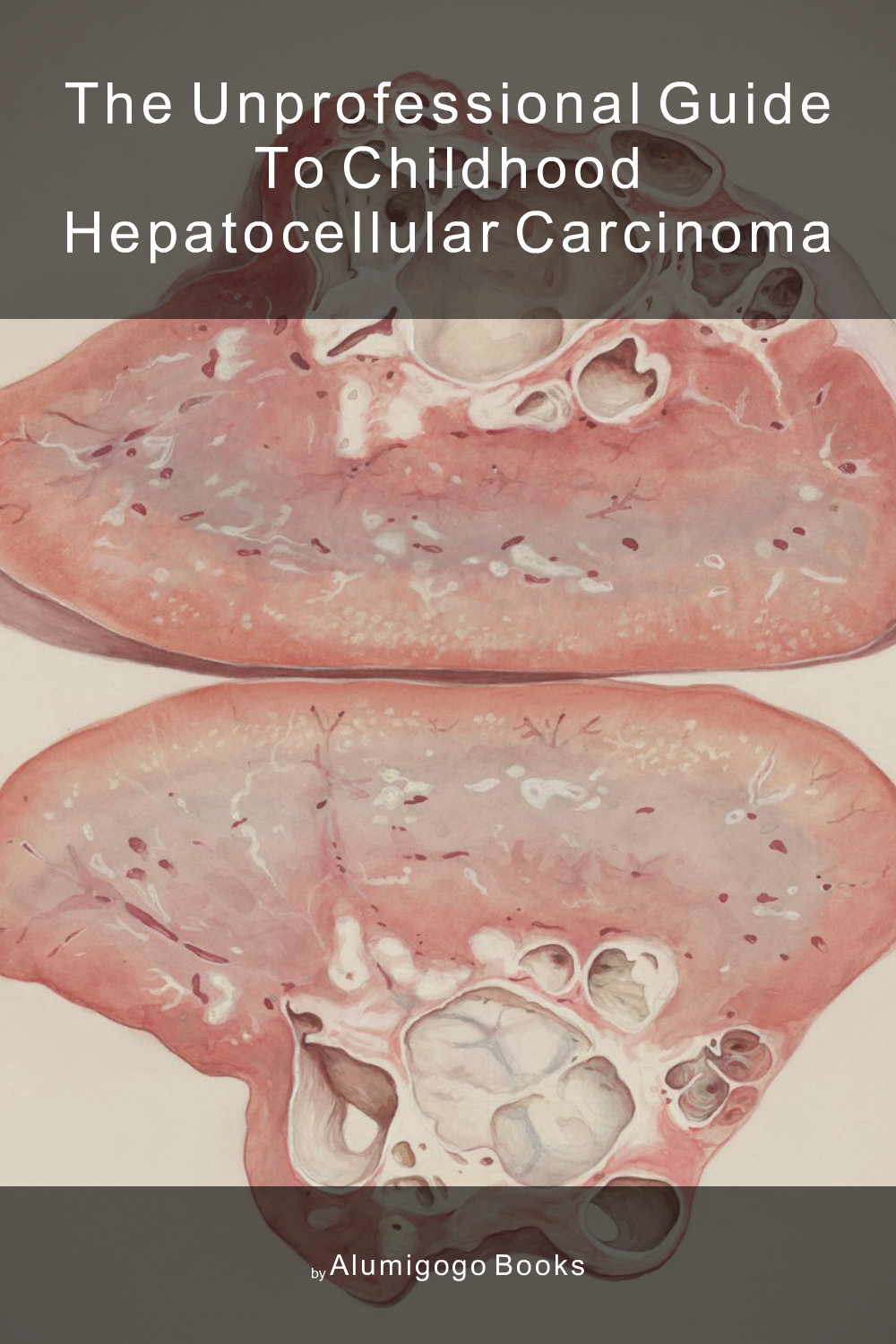 Cover of The Unprofessional Guide to childhood hepatocellular carcinoma