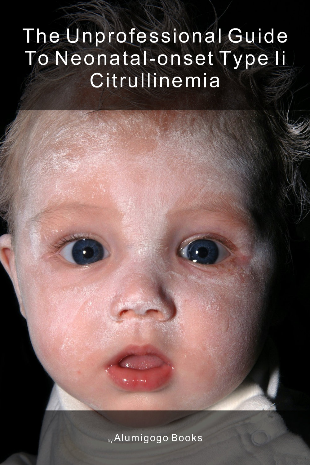 Cover of The Unprofessional Guide to neonatal-onset type II citrullinemia