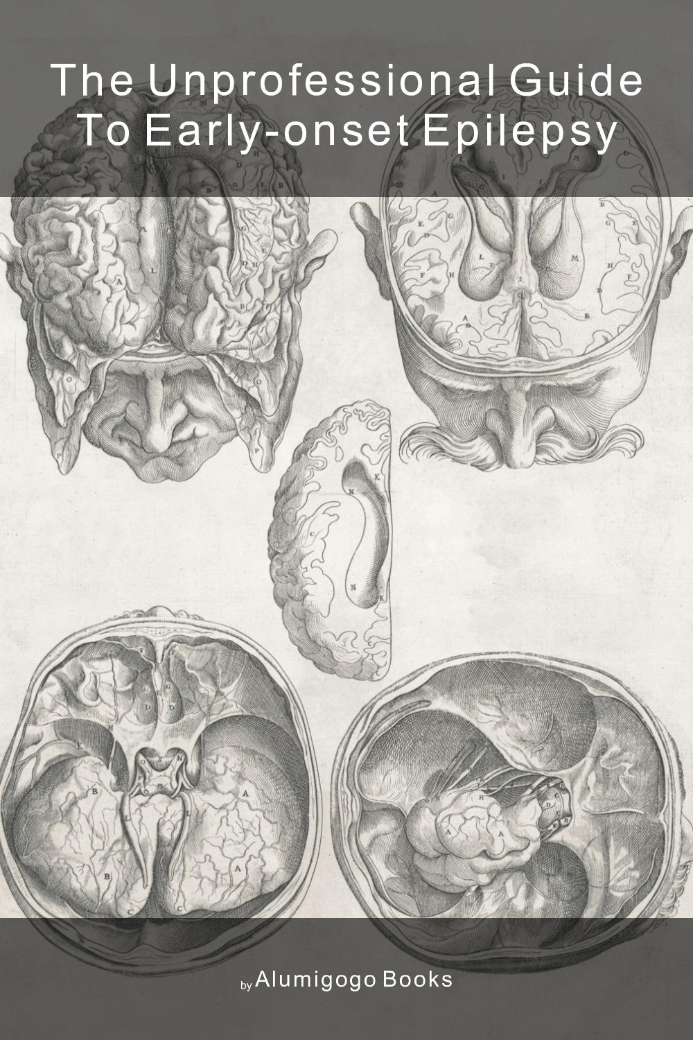Cover of The Unprofessional Guide to early-onset epilepsy