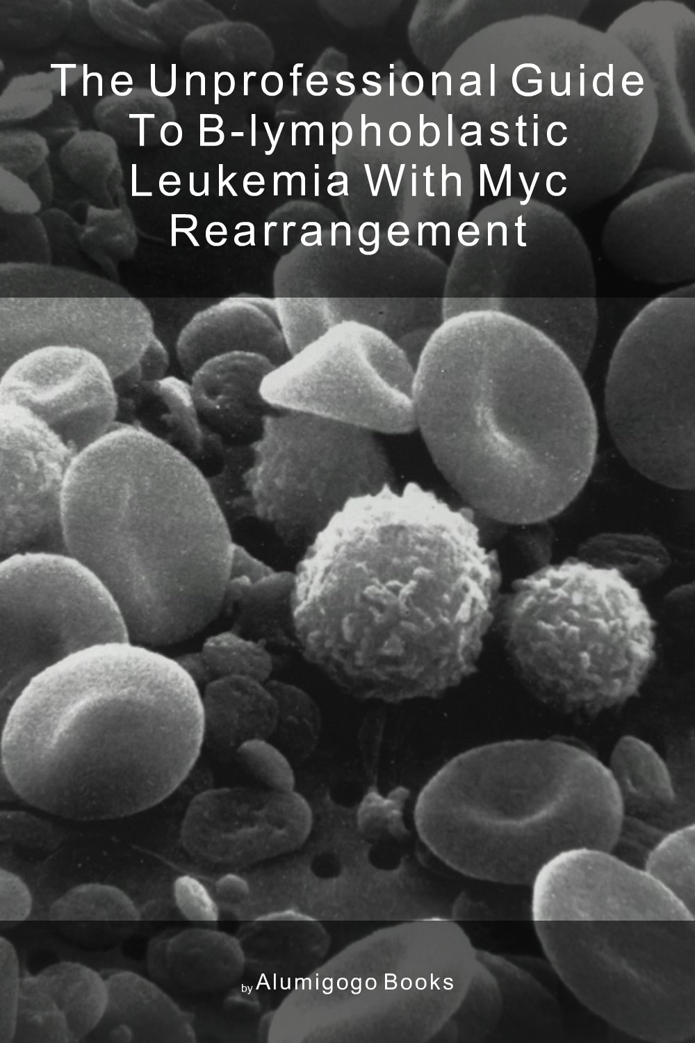 Cover of The Unprofessional Guide to B-lymphoblastic leukemia with MYC rearrangement