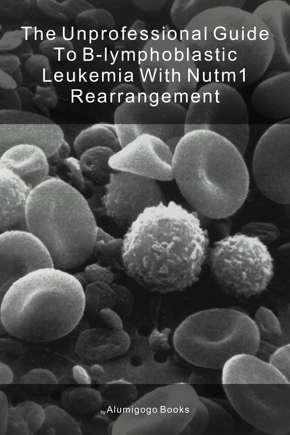 Cover of The Unprofessional Guide to B-lymphoblastic leukemia with NUTM1 rearrangement